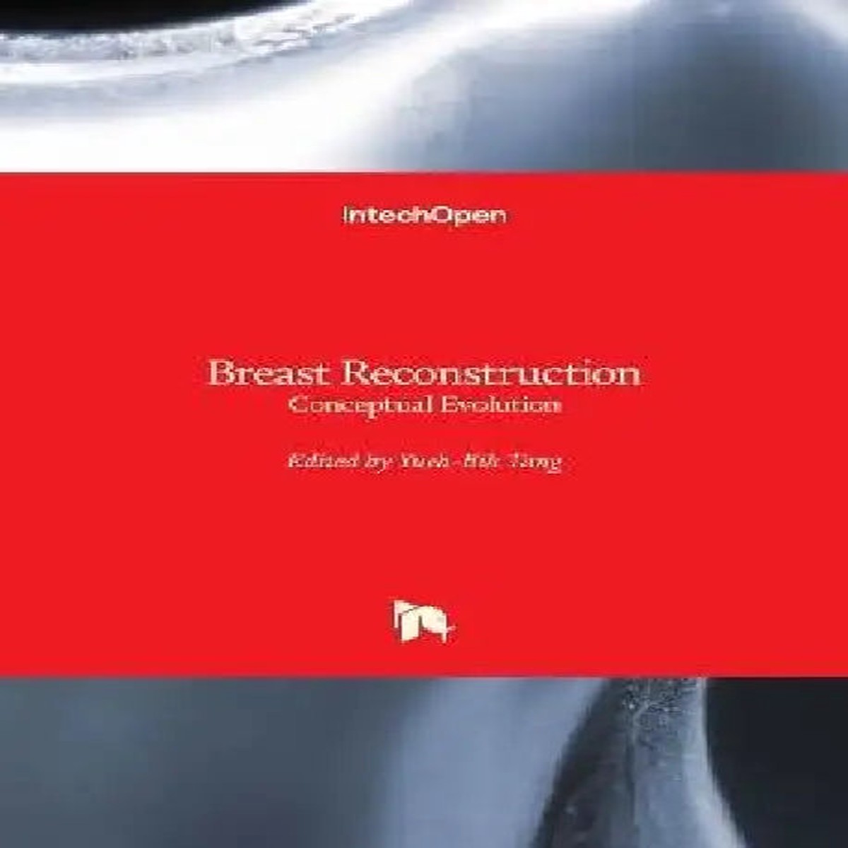 Breast Reconstruction: Conceptual Evolution - Hardcover